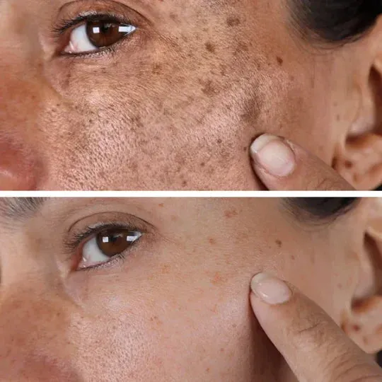 Luminate™ – Glow Serum for Dark Spot Correction