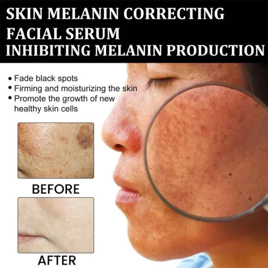 Luminate™ – Glow Serum for Dark Spot Correction